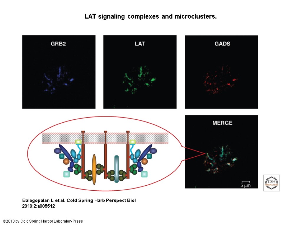 LAT signaling complexes and microclusters. Balagopalan L et al. Cold Spring Harb Perspect Biol